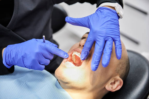 Best Emergency Tooth Extraction in Elkridge, MD